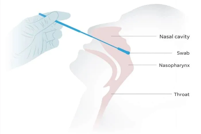Nasal Swab testing